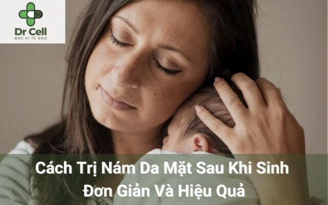 Cách trị nám da mặt sau khi sinh