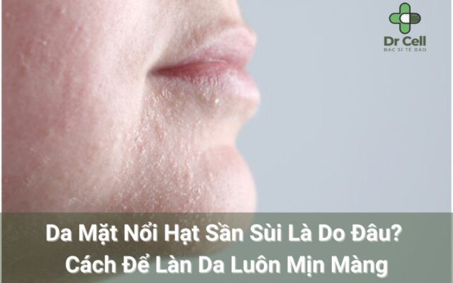 Da mặt nổi hạt sần sùi