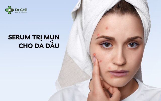 serum trị mụn cho da dầu
