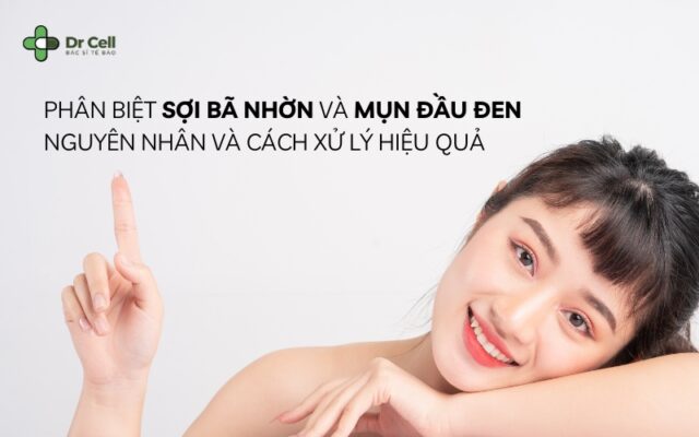 sợi bã nhờn và mụn đầu đen