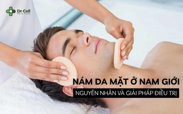 nám da mặt ở nam giới