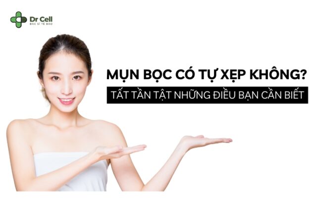 mụn bọc có tự xẹp không
