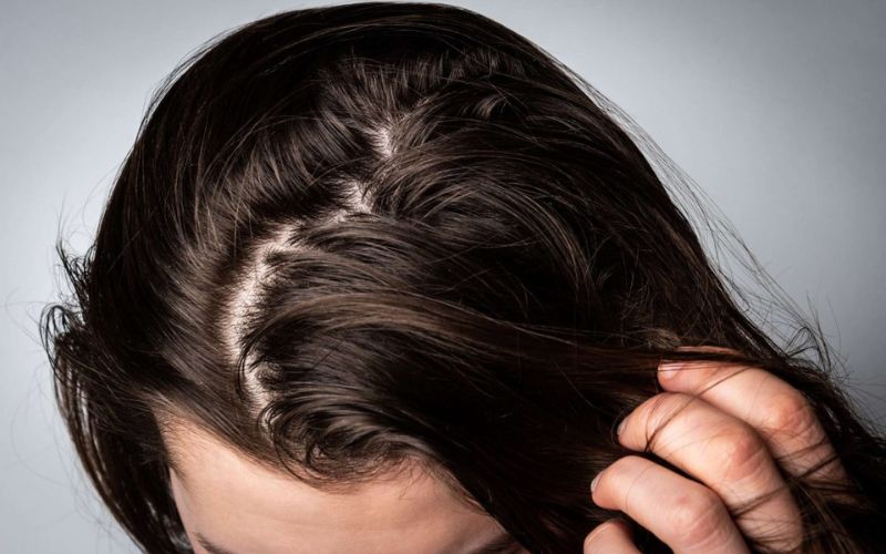 những thói quen cần trán để tóc không bị bết nhanh