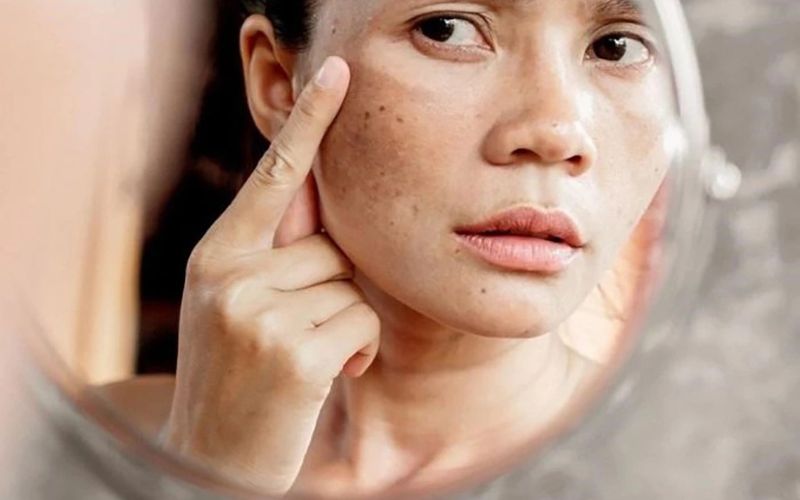 các câu hỏi thường gặp về chống lão hóa da