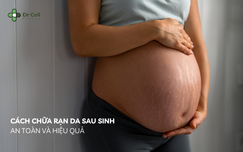 Cách Chữa Rạn Da Sau Sinh An Toàn Và Hiệu Quả